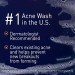 PanOxyl Acne Foaming Wash Benzoyl Peroxide 10% Maximum Strength Antimicrobial, 5.5 Oz - Image 10